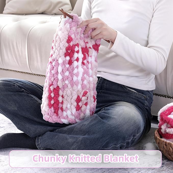 Hombys 8 Pack Giant Chunky Yarn for Crocheting/Hand Knitting - Super Bulky, Soft, Fluffy, Plush, Fuzzy, Thick Chenille Yarn - Tie Dye, Mixed Colors (Rose, Pink, White)